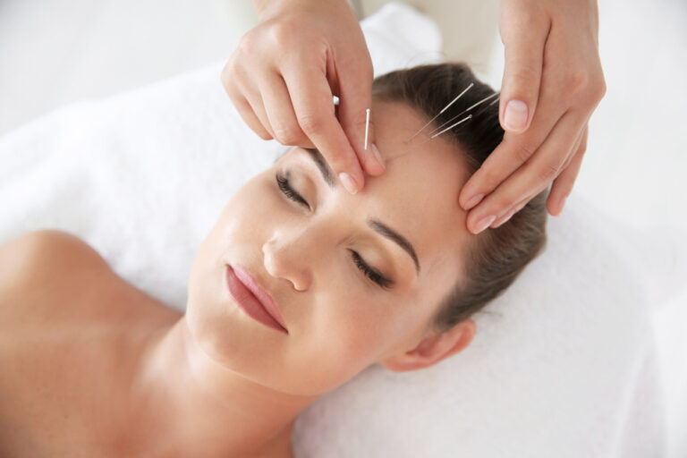 benefits-of-facial-acupuncture-4314888